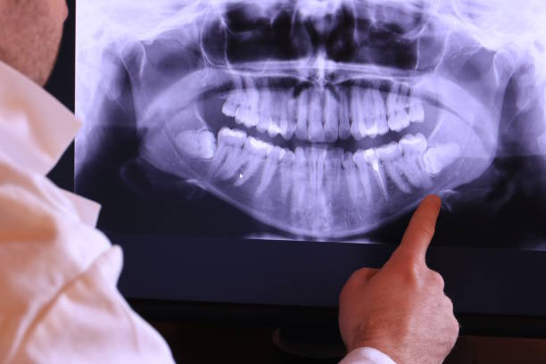 Best Holiday Emergency Dentist in Alpharetta, GA