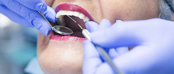 Best Emergency Root Canal Treatment in Alpharetta, GA